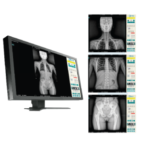 radiologia-digitale-helios-drf