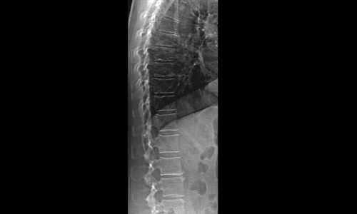 radiologia-digitale-optimum